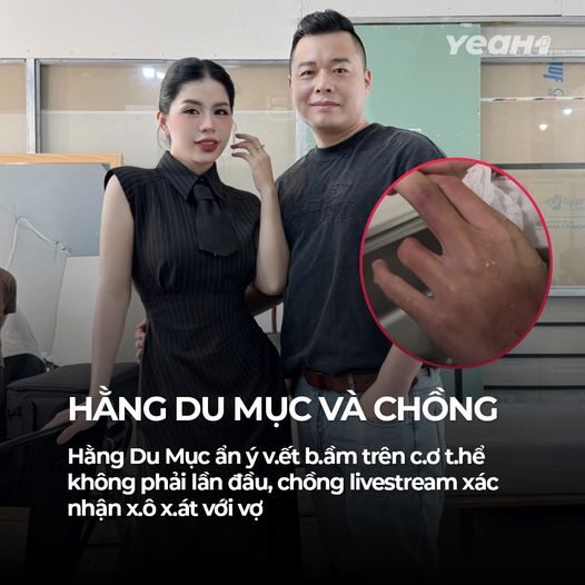 Hằng Du Mục ẩn ý vết bầm trên cơ thể không phải lần đầu, chồng livestream xác nhận xô xát với vợ