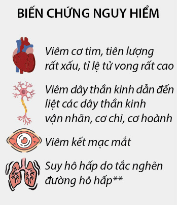 Bệnh bạch hầu nguy hiểm thế nào mà từng được coi là nỗi ám ảnh của thế giới?