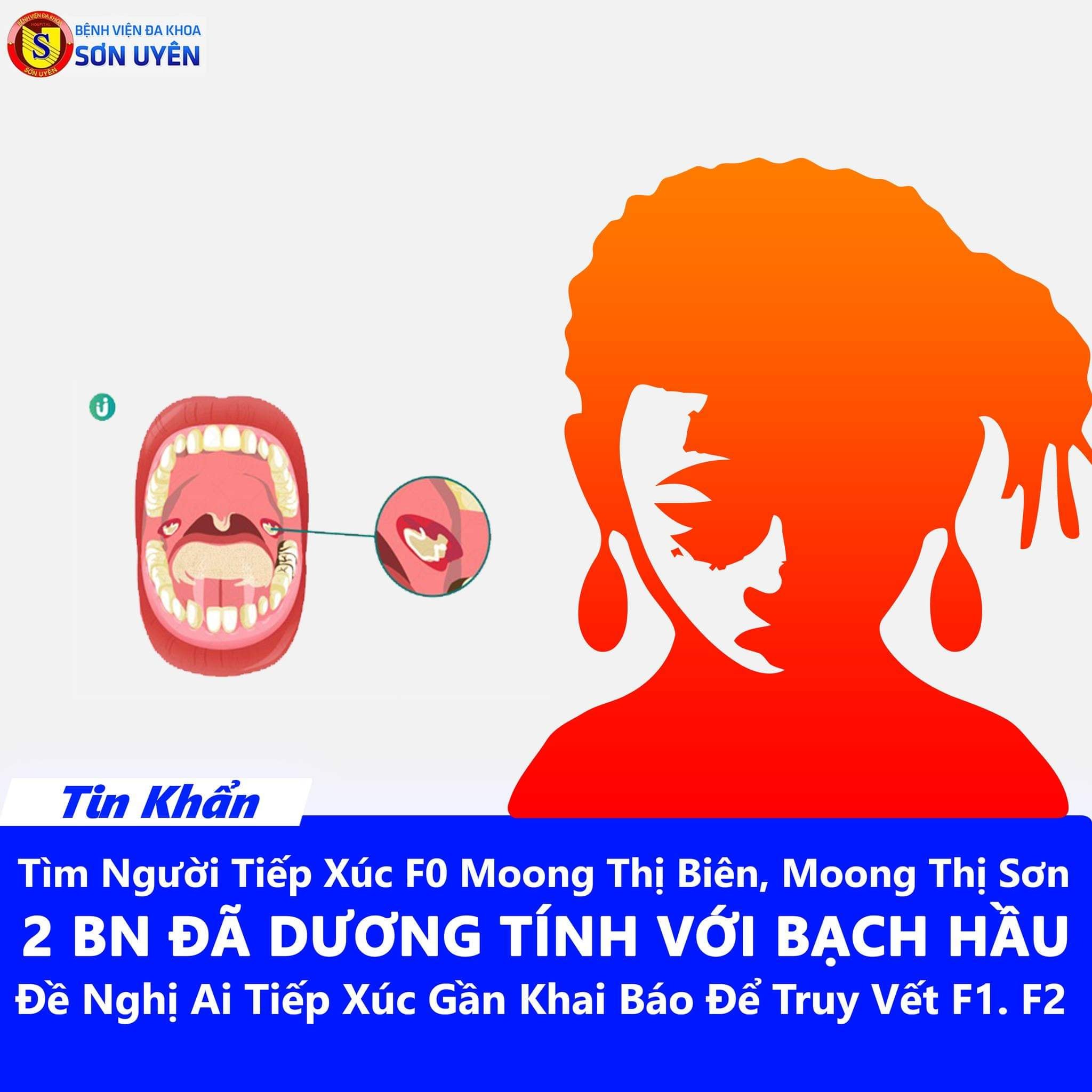 Bắc Giang: Phát hiện một trường hợp dương tính với bệnh bạch hầu